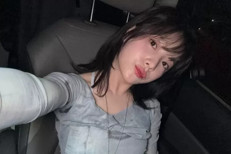 Gugatan atas sengketa senilai lebih dari 8,3 miliar Rupiah dilayangkan oleh Ben kepada mantan agensinya Major9 (instagram.com/mignonben)
